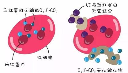 警惕洗澡季隱形殺手 一氧化碳中毒康復后，當心遲發性腦病